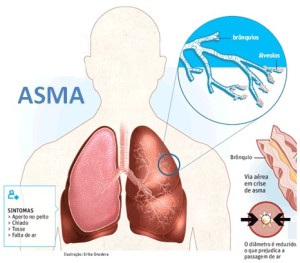 asma akut
